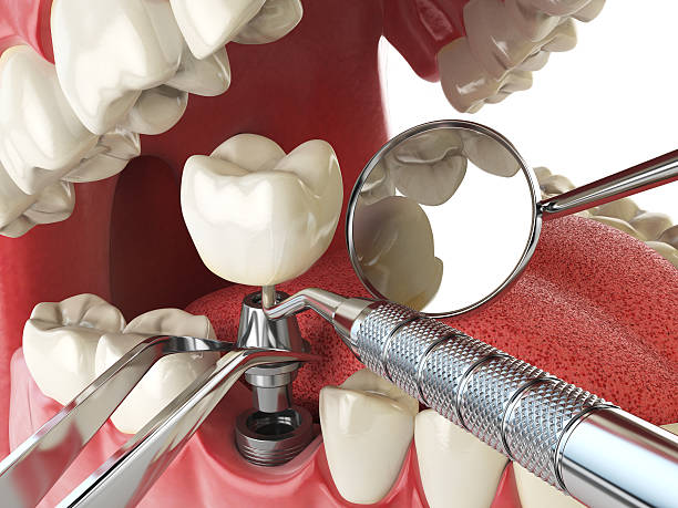 Best Emergency Gum Treatment in Shreveport, LA